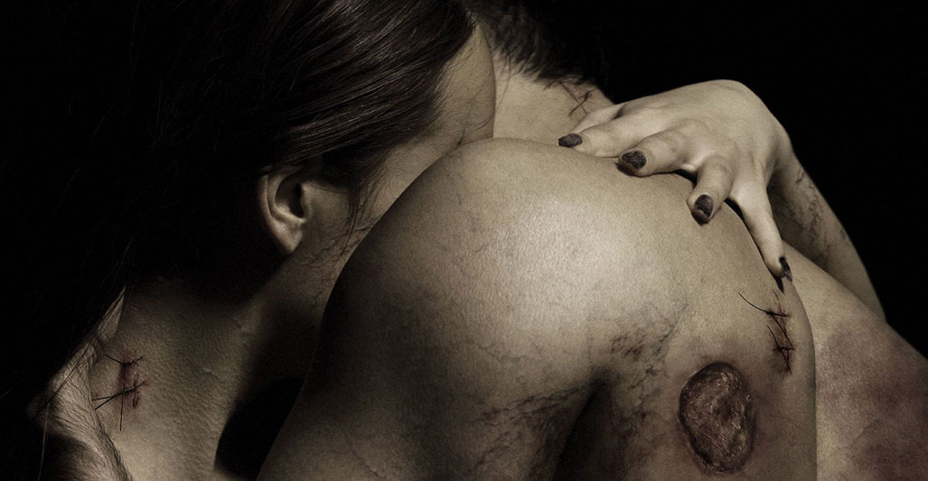 Contracted: Phase II (2015)